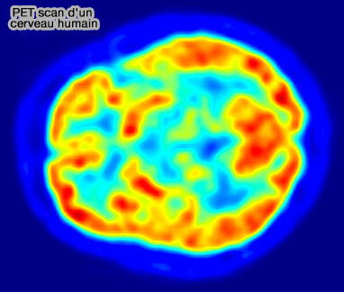 PET scan d'un cerveau humainl