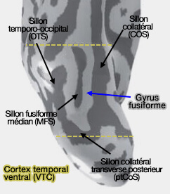 Cortex temporal ventral