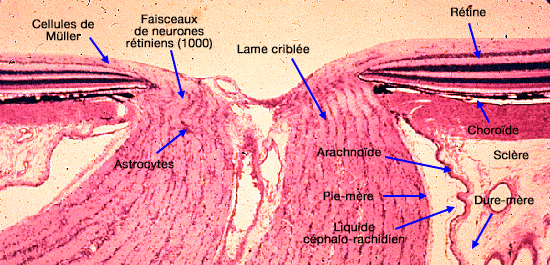 Papille du nerf optique (II)