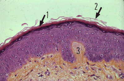 Epithélium pavimenteux kératinisé de type B