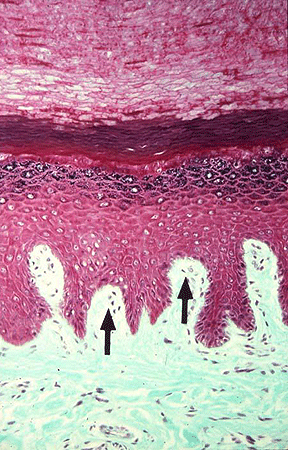 Papilles dermiques du tissu conjonctif lâche