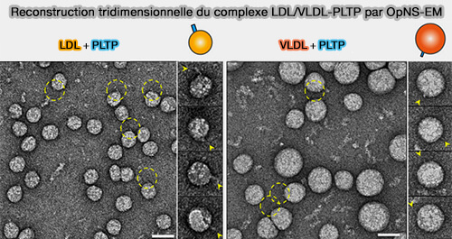 Reconstruction tridimensionnelle du complexe LDL/VLDL-PLTP 