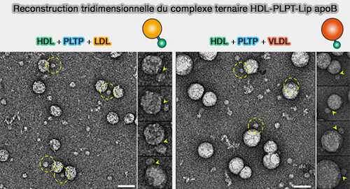 Reconstruction tridimensionnelle du complexe HDL-PLTP-Lip apoB