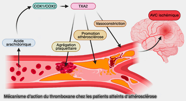 Mécanisme d'action du thromboxane chez les patients atteints d'athérosclérose