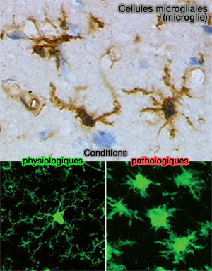 Cellules microgliales (microglie)