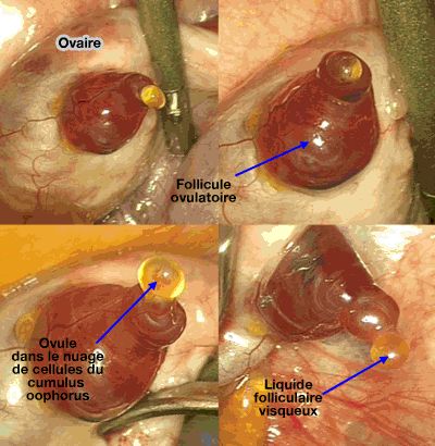 Ovulation (rupture folliculaire)