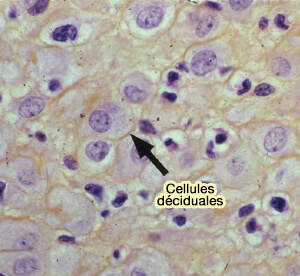 Cellules déciduales