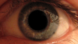 Variation du diamètre pupillaire