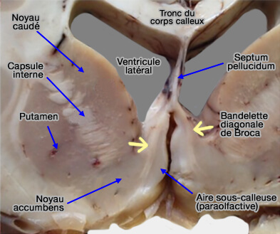 Bandelette diagonale de Broca