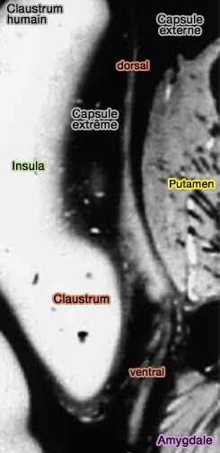 Localisation du cortex piriforme