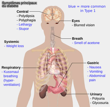 Symptômes principaux du diabète