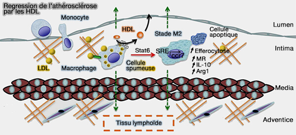 Régression de l'athérosclérose par les HDL