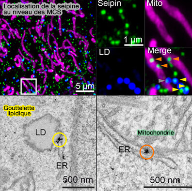 Localisation de la seipine dans les MCS