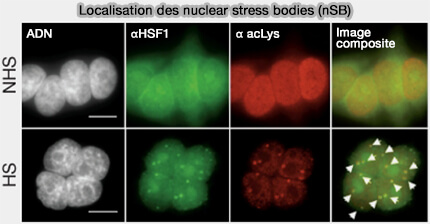 nuclear stress bodies (nSB)