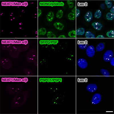 Différentes fonctions des protéines DBHS