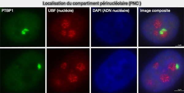 Localisation du compartiment périnucléolaire (PNC)