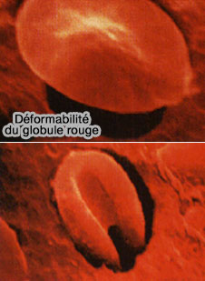 Déformabilité de l'érythrocyte