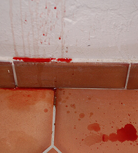 Hématurie et douleur (cystite)