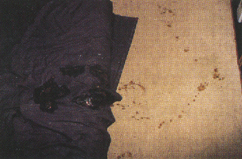 Défécations émotionnelles