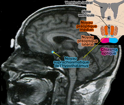 Noyaux suprachiasmatiques de l'hypothalamus