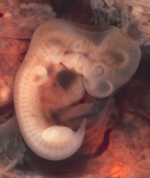 Embryon humain de 7 semaines