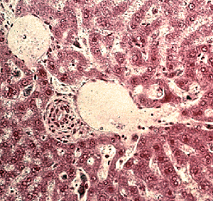 Triade portale hépatique