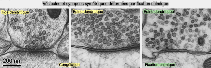 Vésicules et synapses symétriques déformées par fixation chimique