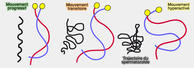 Différents mouvements des spermatozoïdes