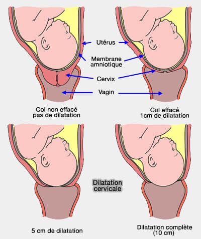 Effacement et dilatation cervicale