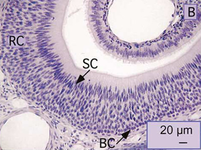 Coupe coronale du VNO